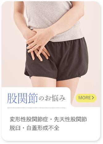 股関節のお悩み
